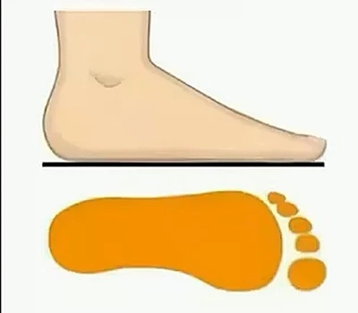 Le guide du professionnel sur l'évaluation des pieds plats : pourquoi une évaluation appropriée e...