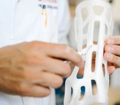 Exportation au format de fichiers STL pour les orthèses imprimées en 3D : comment la numérisation...
