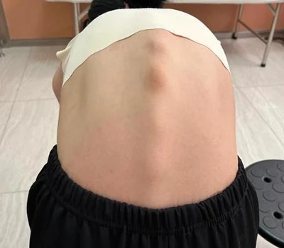 Révolutionner la santé de la colonne vertébrale : le scanner corporel 3D Xianku