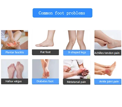 Révolutionner les soins des pieds : le scanner de pieds 3D de Xianku transforme l'orthopédie et l...