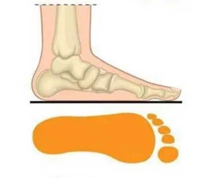 Crérat à pied plat: vérifications manuelles vs. Tapis de pression vs . 3 d Ai scanners