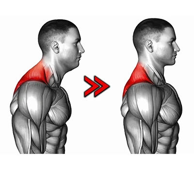 Comprendre la posture de la tête vers l'avant : causes, implications sur la santé et solutions te...
