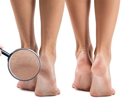 Entrer dans le futur : comment la technologie de numérisation 3D du pied révolutionne les soins p...