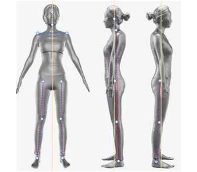 Posture de la tête vers l'avant, inclinaison du bassin et vous : comment le scanner corporel 3D p...