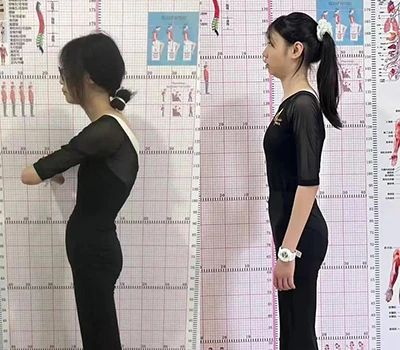 Numérisation de posture 3D vs. Évaluation traditionnelle : pourquoi l'œil nu passe à côté de ques...